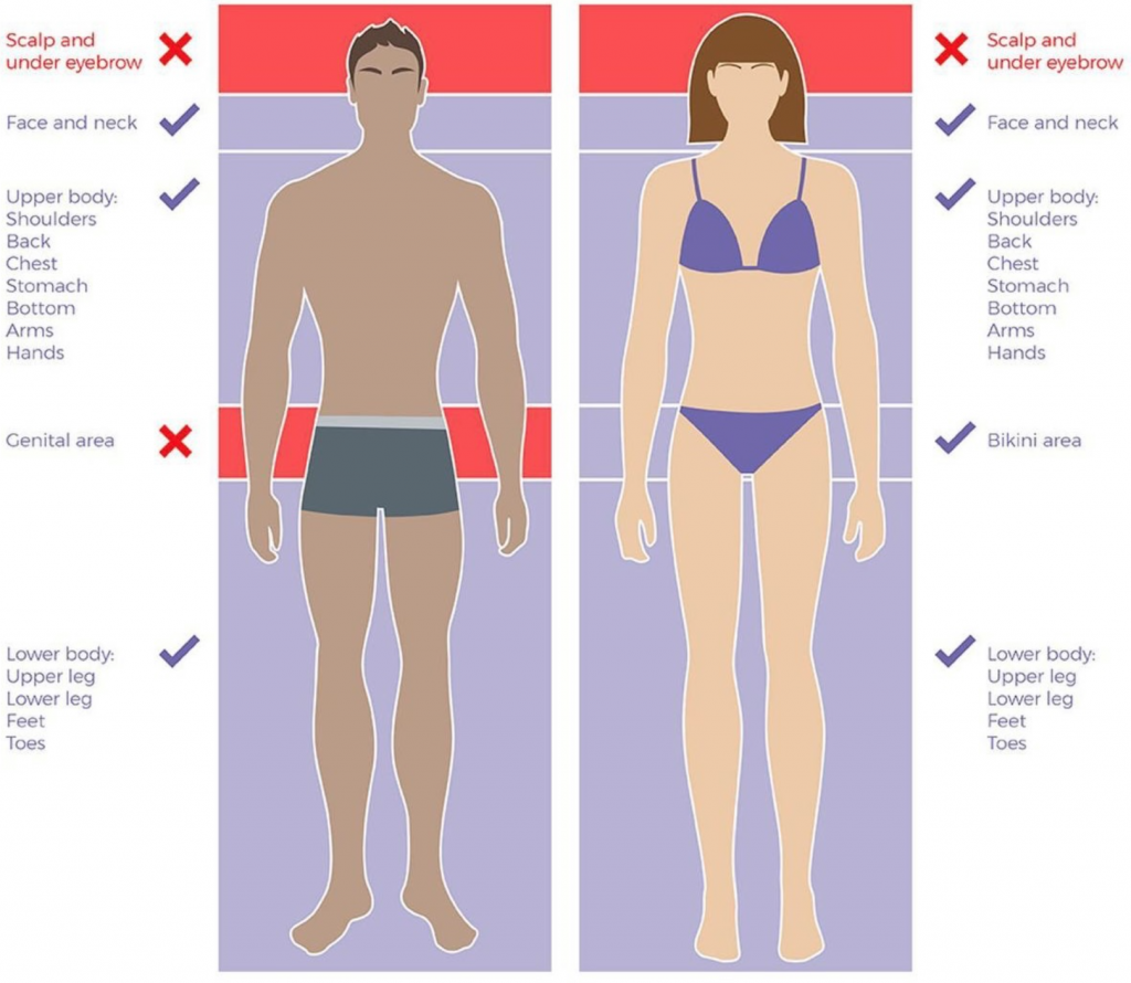 a diagram showing where air removal can take place